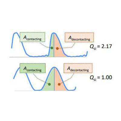 Quantitative and qualitative electroglottographic wave shape differences in children and adults using voice map-based analysis